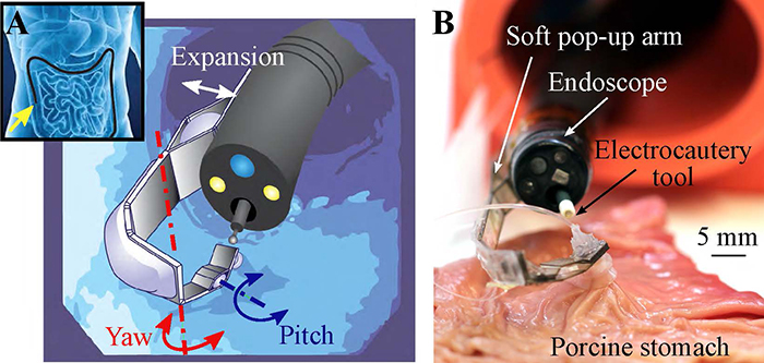 Multi-articulated soft pop-up robotic arm. Concept of the system (left): An endoscope navigating in the GI tract and detail of the arm mounted at the tip of the endoscope. Soft pop-up arm (right) performing tissue counter-traction during an ex-vivo test on a porcine stomach (Image courtesy of Harvard University)
