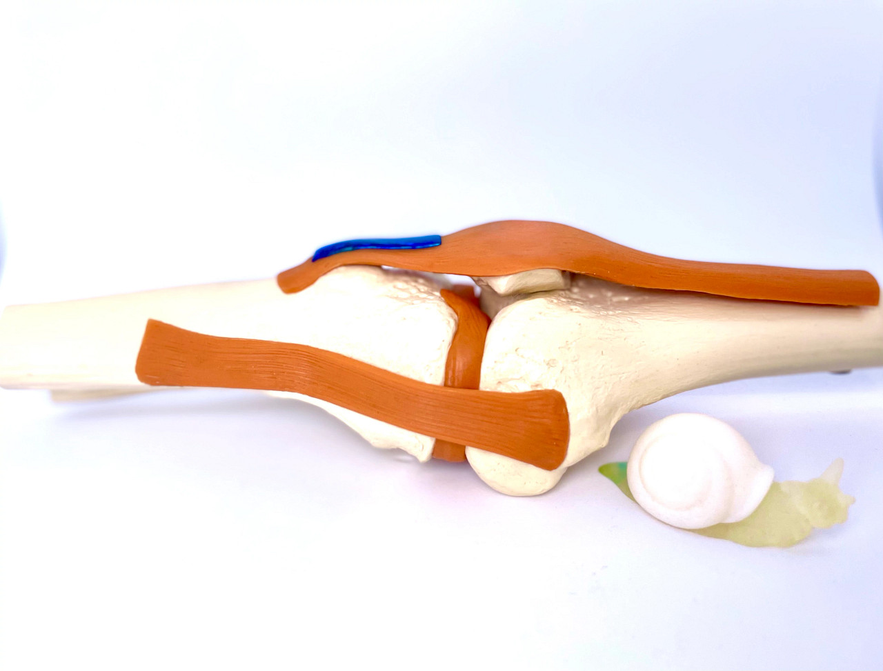 Towards more effective tendon repair with a multi-functional biomaterial - Vimarsana News