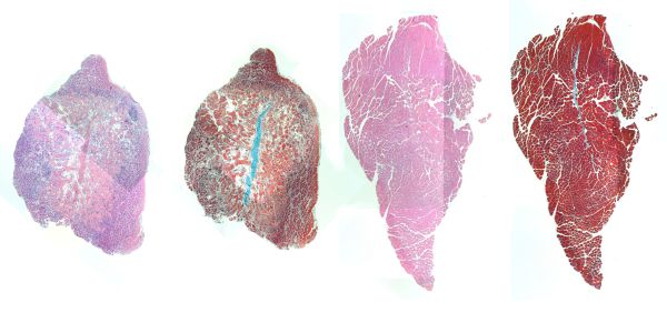 “Stains for cellular components (pink) and muscle fibers (red) in mouse muscle injected with IL-4 nanoparticles show that a muscle that received treatment (right) displayed better regeneration of muscle cells and less empty space in the muscle tissue (white) than a muscle that did not receive treatment (left). Credit: Wyss Institute at Harvard University
