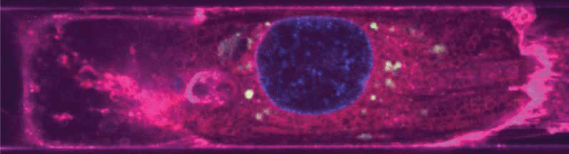 image of a cardiomyocyte