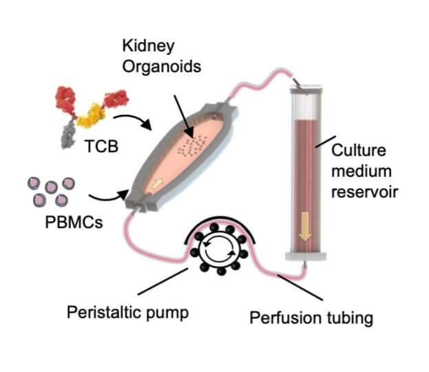  Illustration explains how the immune-infiltrated kidney organoid-on-chip model works