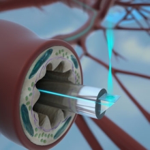 endoscope (Credit: Harvard University/Massachusetts General Hospital)