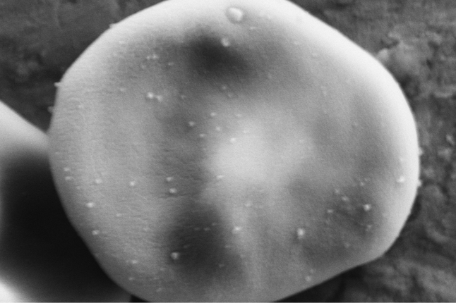 An SEM image of the nanoparticles on the red blood cell 