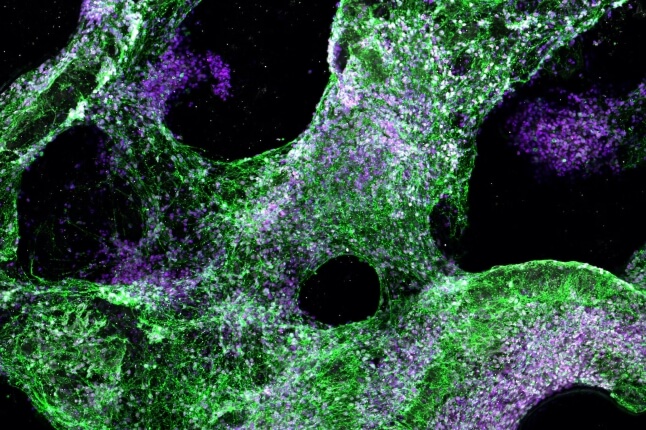 Image of human neural progenitor cells differentiating on the hydrogel scaffold